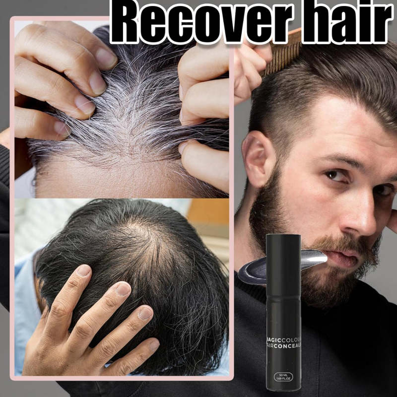 ⌛Denne ukens spesial🔥Scalp Concealer for fyldigere, naturlig hå